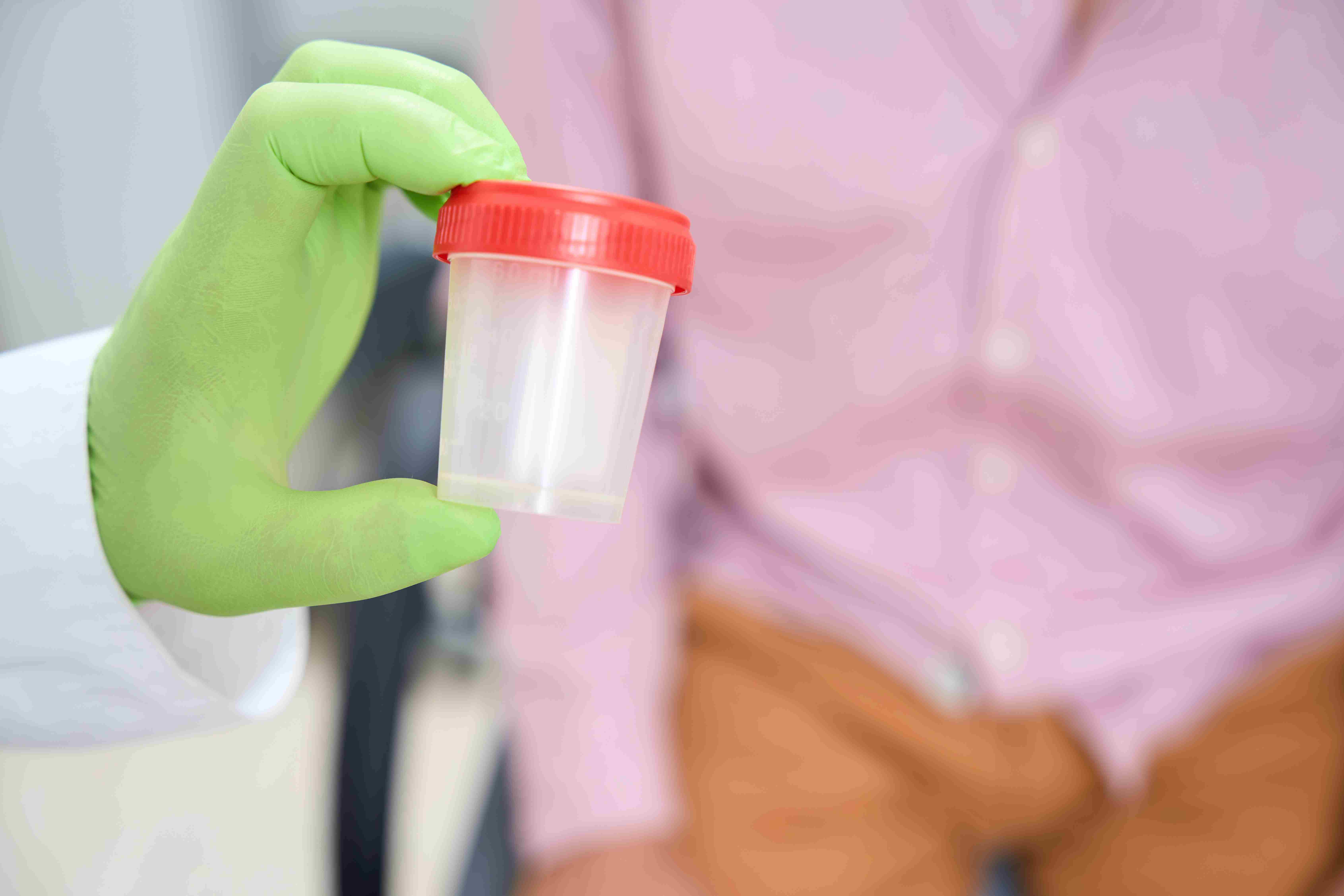 A doctor holding up a pee cup